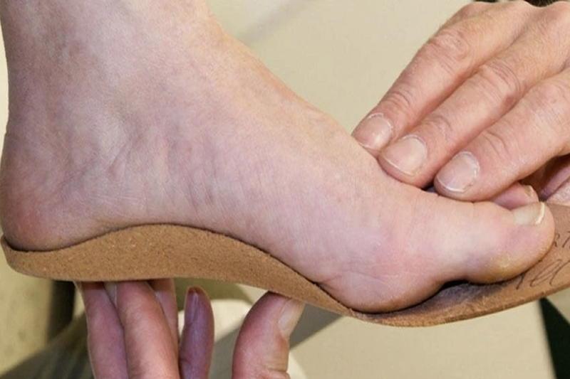 orthotics-fitting