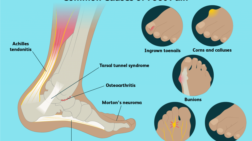 Foot Ankle Surgery and Some Causes