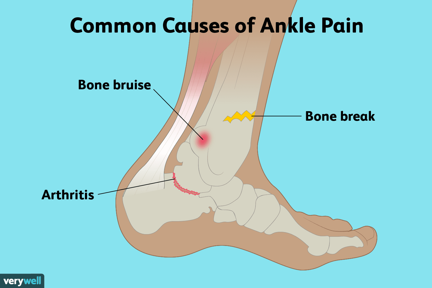 What Is At The Back Of Your Ankle